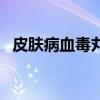 皮膚病血毒丸（關于皮膚病血毒丸的介紹）