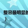 整容最明顯的明星（明星最愛整容部位排行榜）