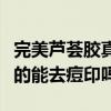 完美蘆薈膠真的可以祛痘印嗎（完美蘆薈膠真的能去痘印嗎）