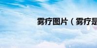 霧療圖片(霧療是什么)