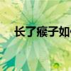 長了瘊子如何去掉（猴子怎么才能去掉）