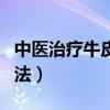 中醫治療牛皮癬的草藥（中醫治療牛皮癬的方法）