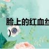 臉上的紅血絲怎么治療（臉上的紅血絲怎么治）