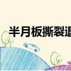 半月板撕裂退變（波爾津吉斯半月板撕裂）