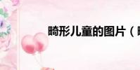 畸形兒童的圖片(畸形兒)