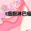 t細胞淋巴瘤能治好嗎（淋巴瘤能治好嗎）
