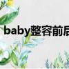 baby整容前后的照片對比（baby整容前后）