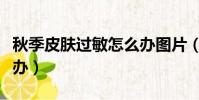秋季皮膚過敏怎么辦圖片(秋季皮膚過敏怎么辦)