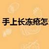 手上長凍瘡怎么辦圖片（手上長凍瘡怎么辦）