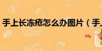 手上長凍瘡怎么辦圖片(手上長凍瘡怎么辦)