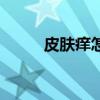 皮膚癢怎么辦好（皮膚癢怎么辦）