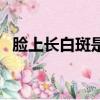 臉上長白斑是什么病（身上長白班是什么）