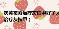 灰黃霉素治療灰指甲好了又復發了(灰黃霉素治療灰指甲)