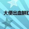 大便出血鮮紅色不痛不癢怎么回事（大便）