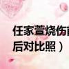 任家萱燒傷前后對比照 新聞（任家萱燒傷前后對比照）