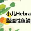 小兒Hebra脂溢性魚鱗病（關于小兒Hebra脂溢性魚鱗病簡介）