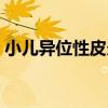 小兒異位性皮炎（關于小兒異位性皮炎簡介）