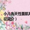 小兒先天性面肌雙癱綜合征（關于小兒先天性面肌雙癱綜合征簡介）