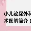 小兒泌尿外科手術圖解（關于小兒泌尿外科手術圖解簡介）