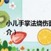 小兒手掌法燒傷面積計算（關于小兒手掌法燒傷面積計算簡介）