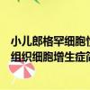 小兒郎格罕細胞性組織細胞增生癥（關于小兒郎格罕細胞性組織細胞增生癥簡介）