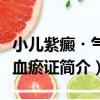 小兒紫癜?氣滯血瘀證（關于小兒紫癜?氣滯血瘀證簡介）
