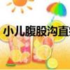 小兒腹股溝直疝（關于小兒腹股溝直疝簡介）