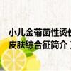 小兒金葡菌性燙傷樣皮膚綜合征（關于小兒金葡菌性燙傷樣皮膚綜合征簡介）