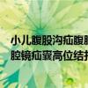 小兒腹股溝疝腹腔鏡疝囊高位結扎術（關于小兒腹股溝疝腹腔鏡疝囊高位結扎術簡介）