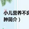 小兒營養不良性水腫（關于小兒營養不良性水腫簡介）