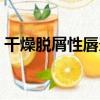 干燥脫屑性唇炎（關于干燥脫屑性唇炎介紹）