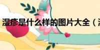 濕疹是什么樣的圖片大全(濕疹是什么樣的)