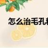 怎么治毛孔粗大有黑頭粉刺用什么護膚品