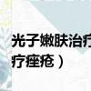 光子嫩膚治療痤瘡一般多久一次（光子嫩膚治療痤瘡）