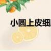 小圓上皮細胞（關于小圓上皮細胞簡介）
