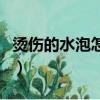 燙傷的水泡怎么處理好（燙傷的水泡怎么處理）