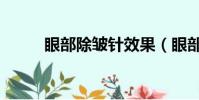 眼部除皺針效果(眼部注射祛皺)