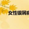 女性銀屑病頭發的圖片（女性銀屑病）