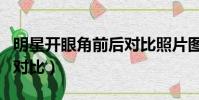 明星開眼角前后對比照片圖(明星開眼角前后對比)