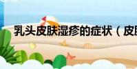 乳頭皮膚濕疹的癥狀(皮膚濕疹的癥狀)
