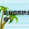 后背痘痘擠出來黑色硬硬的什么東西（后背痘痘）