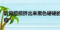 后背痘痘擠出來黑色硬硬的什么東西(后背痘痘)