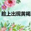 臉上出現黃褐斑怎么回事（黃褐斑怎么回事）