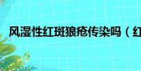 風濕性紅斑狼瘡傳染嗎(紅斑狼瘡傳染嗎)