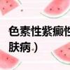 色素性紫癜性皮膚病的癥狀（色素性紫癜性皮膚病）