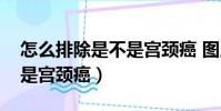 怎么排除是不是宮頸癌 圖片(怎么排除是不是宮頸癌)