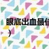 眼底出血最佳治療方法（眼底出血的治療方法）