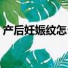 產后妊娠紋怎么除掉（產后妊辰紋能去掉嗎）