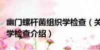 幽門螺桿菌組織學檢查(關于幽門螺桿菌組織學檢查介紹)
