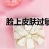 臉上皮膚過敏起疙瘩咋辦（臉上皮膚過敏）